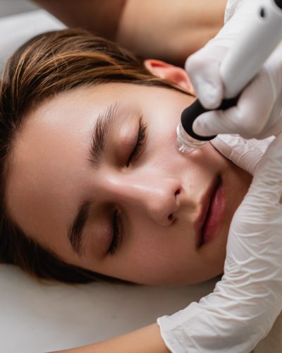 Facial skin hydropeeling.